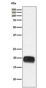 Anti-Mammaglobin A Rabbit Monoclonal Antibody Boster Bio
