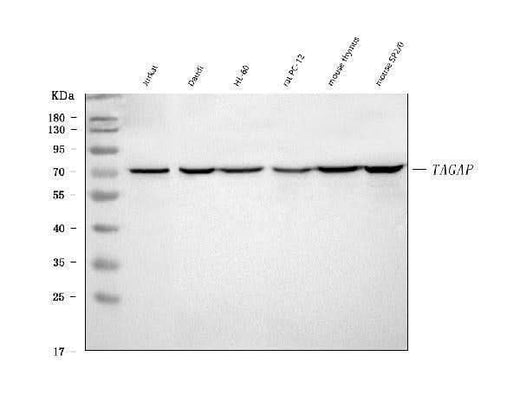 Anti-TAGAP Rabbit Monoclonal Antibody Boster Bio