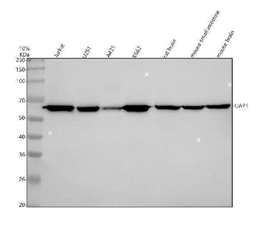 Anti-UAP1 Rabbit Monoclonal Antibody Boster Bio