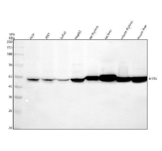 Anti-MST4 Rabbit Monoclonal Antibody Boster Bio
