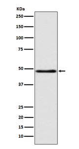 Anti-GCET1 SERPINA9 Rabbit Monoclonal Antibody Boster Bio