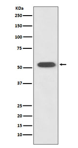 Anti-HSPA14 Rabbit Monoclonal Antibody Boster Bio
