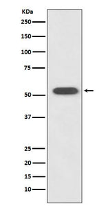 Anti-HSPA14 Rabbit Monoclonal Antibody Boster Bio