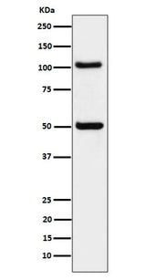 Anti-ORP1 Rabbit Monoclonal Antibody Boster Bio