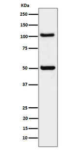 Anti-ORP1 Rabbit Monoclonal Antibody Boster Bio