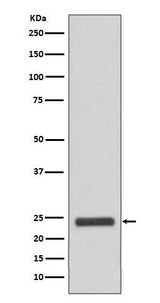 Anti-MRRF Rabbit Monoclonal Antibody Boster Bio