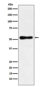 Anti-ROR beta Rabbit Monoclonal Antibody Boster Bio