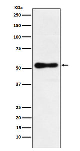 Anti-ROR beta Rabbit Monoclonal Antibody Boster Bio