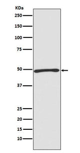 Anti-Atg4C Rabbit Monoclonal Antibody Boster Bio