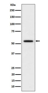 Anti-p60 katanin Rabbit Monoclonal Antibody Boster Bio