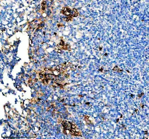 Anti-CD163L1 Rabbit Monoclonal Antibody Boster Bio