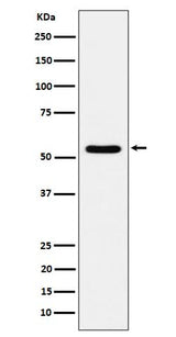 Anti-TOE1 Rabbit Monoclonal Antibody Boster Bio