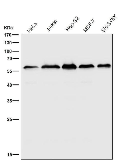 Anti-KLC3 Rabbit Monoclonal Antibody Boster Bio