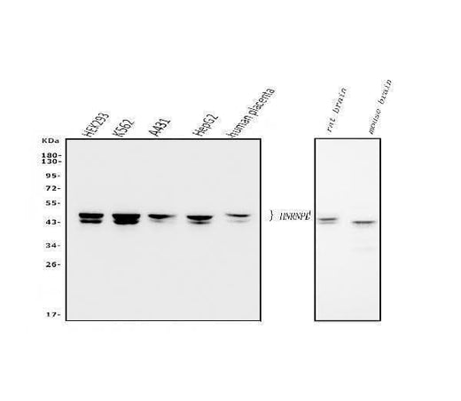 Anti-hnRNP D/AUF1/HNRNPD Antibody Picoband® (monoclonal, 2B12 Boster Bio