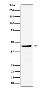 Anti-NDRG3 Rabbit Monoclonal Antibody Boster Bio