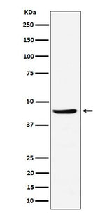 Anti-NDRG3 Rabbit Monoclonal Antibody Boster Bio