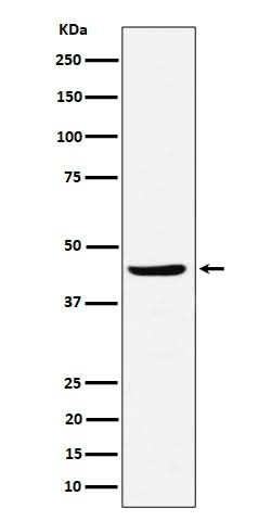 Anti-NDRG3 Rabbit Monoclonal Antibody Boster Bio