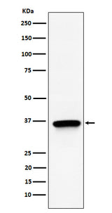 Anti-TIMM50 Rabbit Monoclonal Antibody Boster Bio