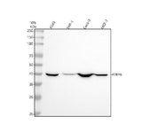 Anti-P2Y6 Rabbit Monoclonal Antibody Boster Bio