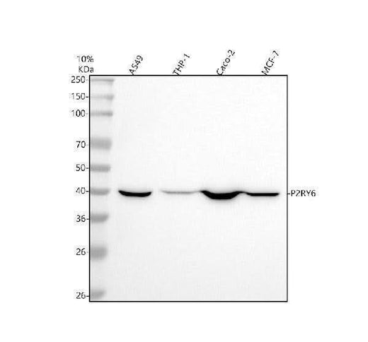Anti-P2Y6 Rabbit Monoclonal Antibody Boster Bio
