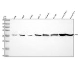Anti-UPP1 Rabbit Monoclonal Antibody Boster Bio