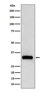 Anti-NDUFAF1 Rabbit Monoclonal Antibody Boster Bio