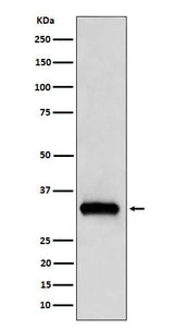 Anti-NDUFAF1 Rabbit Monoclonal Antibody Boster Bio