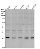 Anti-Neurogenin 2 Rabbit Monoclonal Antibody Boster Bio