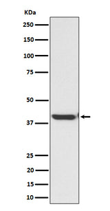 Anti-ENDOGL1 / ENGL Rabbit Monoclonal Antibody Boster Bio
