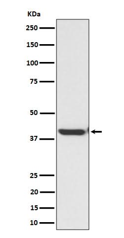 Anti-ENDOGL1 / ENGL Rabbit Monoclonal Antibody Boster Bio
