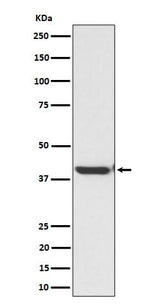 Anti-ENDOGL1 / ENGL Rabbit Monoclonal Antibody Boster Bio