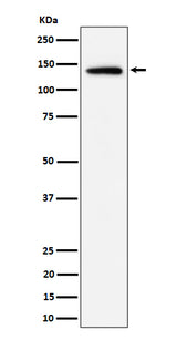 Anti-Importin 9 / RANBP9 Rabbit Monoclonal Antibody Boster Bio