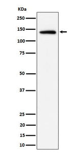 Anti-Importin 9 / RANBP9 Rabbit Monoclonal Antibody Boster Bio
