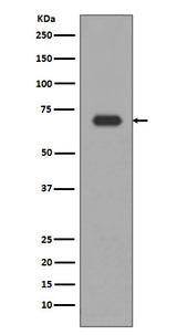Anti-Alas1/Alas H Rabbit Monoclonal Antibody Boster Bio