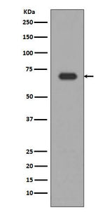 Anti-Alas1/Alas H Rabbit Monoclonal Antibody Boster Bio