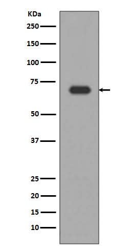 Anti-Alas1/Alas H Rabbit Monoclonal Antibody Boster Bio