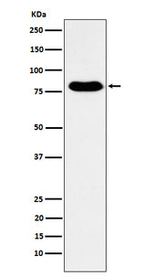 Anti-GTPBP4 Rabbit Monoclonal Antibody Boster Bio