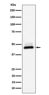 Anti-DNAJA4 Rabbit Monoclonal Antibody Boster Bio