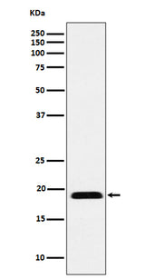 Anti-MYL12B Rabbit Monoclonal Antibody Boster Bio