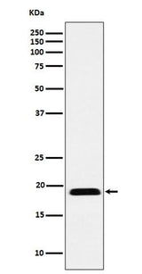 Anti-MYL12B Rabbit Monoclonal Antibody Boster Bio