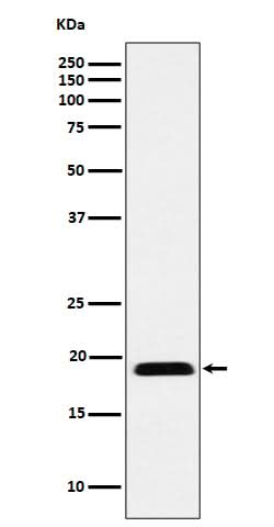 Anti-MYL12B Rabbit Monoclonal Antibody Boster Bio