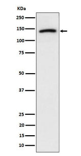 Anti-Cadherin 10 Rabbit Monoclonal Antibody Boster Bio