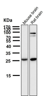 Anti-SCGN Monoclonal Antibody Boster Bio