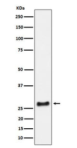 Anti-SNRPA1 Rabbit Monoclonal Antibody Boster Bio