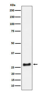Anti-SNRPA1 Rabbit Monoclonal Antibody Boster Bio
