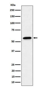 Anti-SF3A3 Rabbit Monoclonal Antibody Boster Bio
