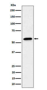 Anti-SF3A3 Rabbit Monoclonal Antibody Boster Bio