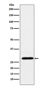 Anti-RGS18 Rabbit Monoclonal Antibody Boster Bio