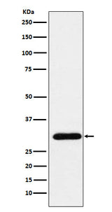 Anti-GTF2F2 Rabbit Monoclonal Antibody Boster Bio