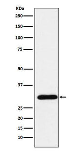 Anti-GTF2F2 Rabbit Monoclonal Antibody Boster Bio